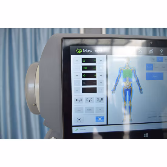 Medical Equipment High Frequency Digital Portable X-ray Machine